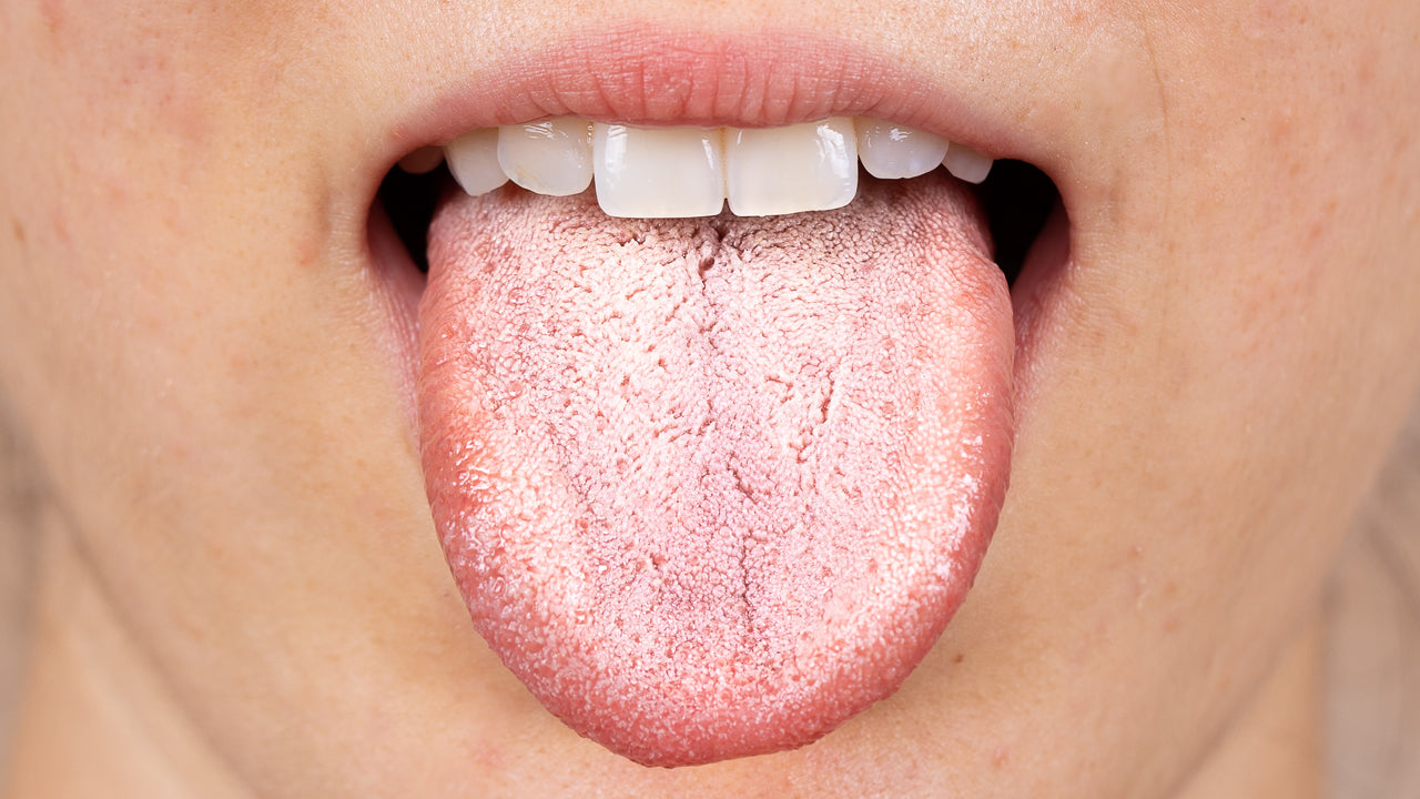 Suffering from Dry Mouth (Xerostomia) Symptoms?